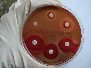 Die "richtigen" antibiotischen Eutertuben ergeben sich aus dem Antibiogramm
