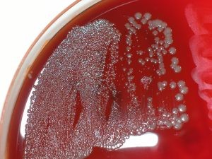 E.coli Kulturen
